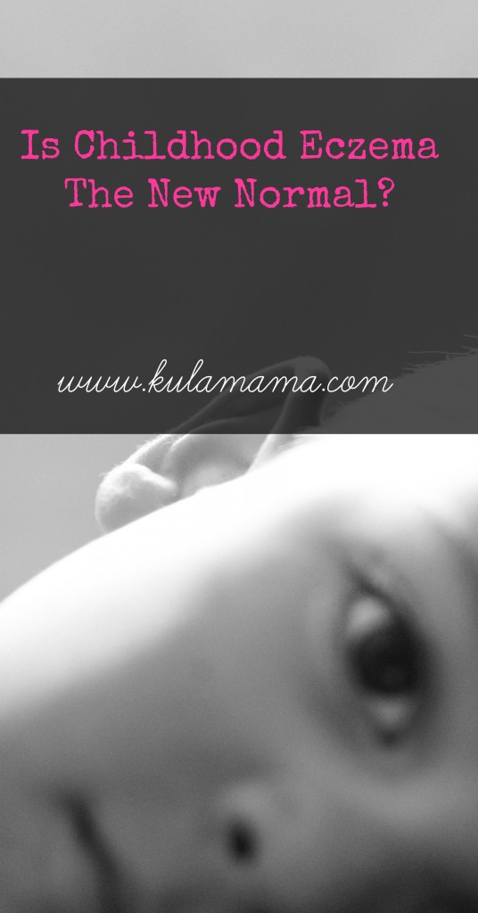 Childhood Eczema Causes and Holistic Remedies by Kula Mama