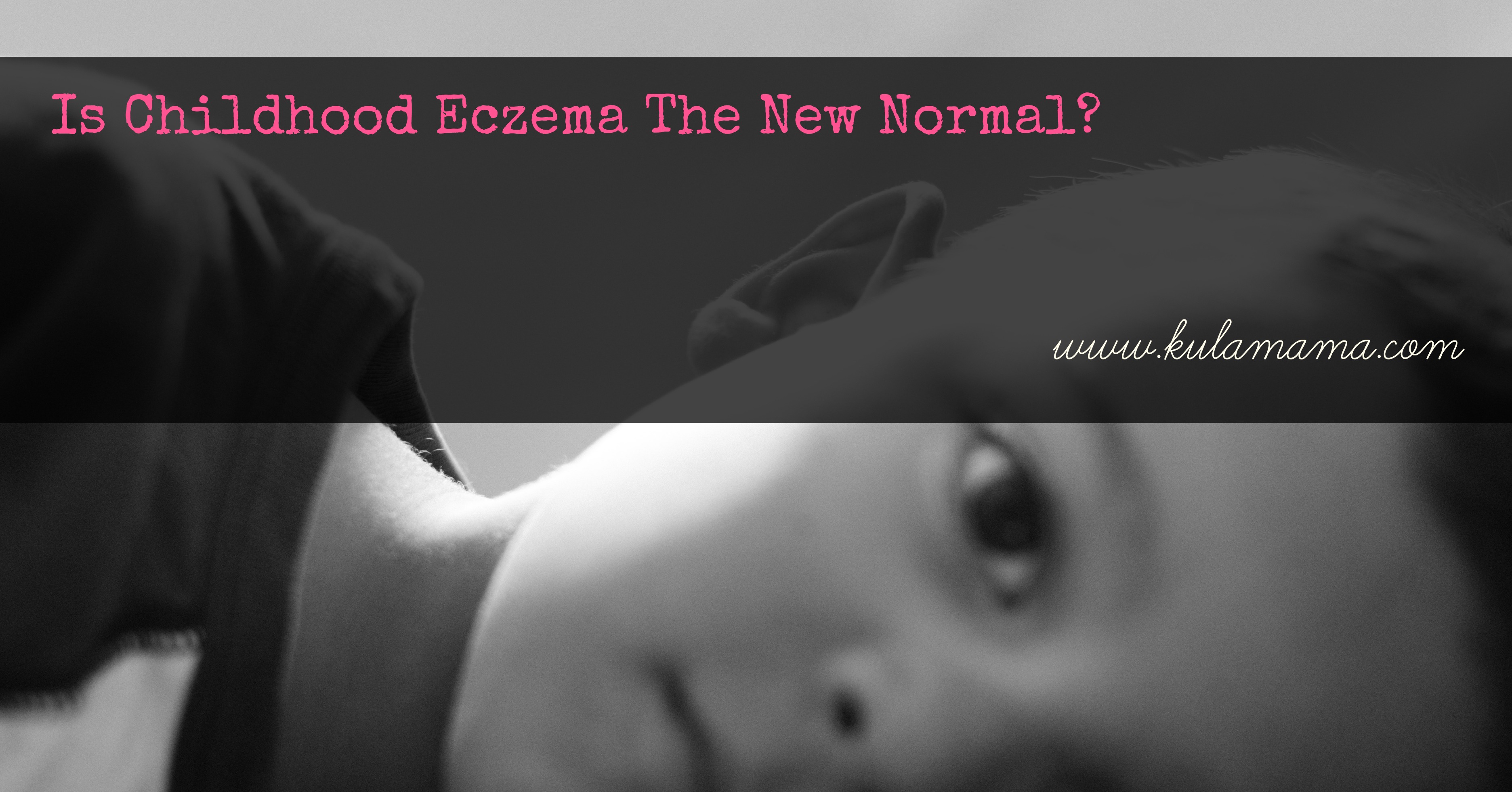 Is Childhood Eczema The New Normal?
