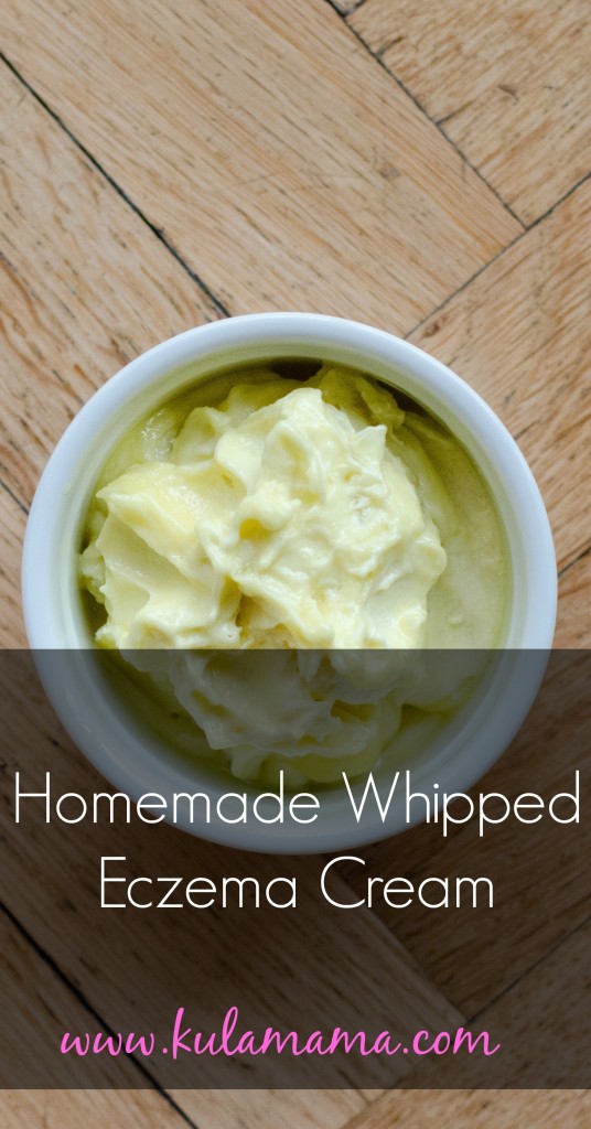 Homemade whipped eczema cream by www.kulamama.com
