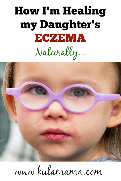 how to heal childhood eczema naturally by www.kulamama.com